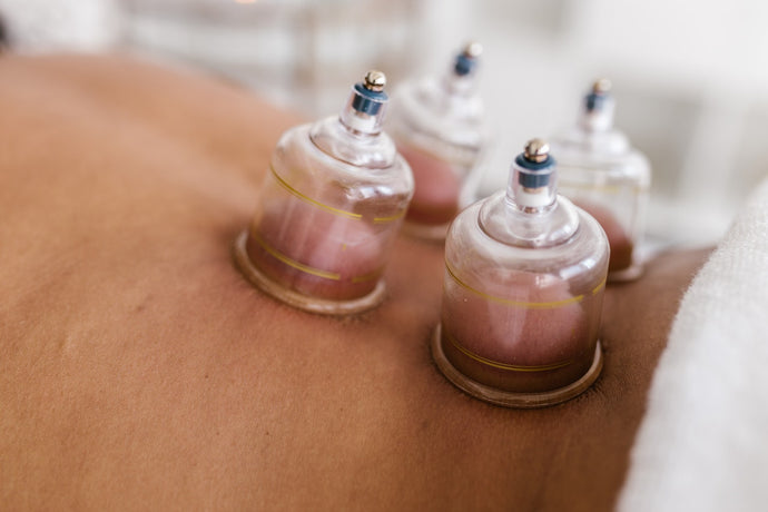 What is Cupping Massage Therapy?